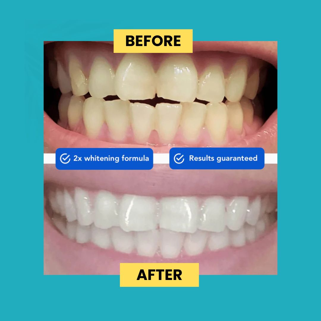 Guru Nanda™️ Coconut Oil Pulling w/ Essential Oils (FREE GIFTS INCLUDED TODAY)