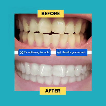 Guru Nanda™️ Coconut Oil Pulling w/ Essential Oils (FREE GIFTS INCLUDED TODAY)