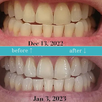 Guru Nanda™️ Coconut Oil Pulling w/ Essential Oils (FREE GIFTS INCLUDED TODAY)