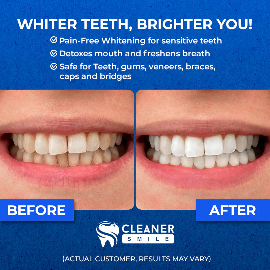 Galmio™ Cleaner Smile Teeth Whitening Kit